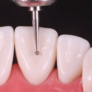 Axis dental fraises dentaires